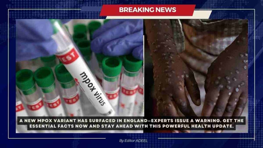 New MPOX Variant